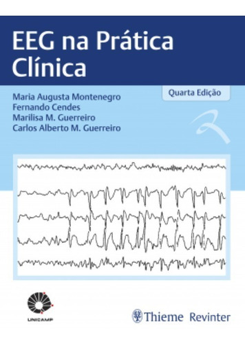 Eeg Na Prática Clínica
