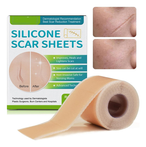 Parches De Silicona Para Cicatricescinta De Silicona
