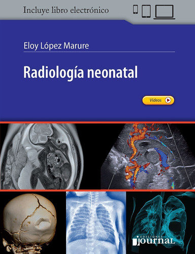 Lopez Marure Radiología Neonatal Nuevo C/envíos T/país