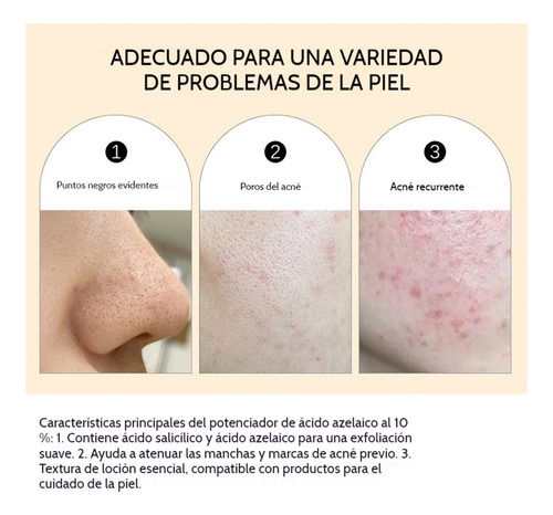 Suero De Ácido Azelaico De Crema Esencia Facial Exfoliante