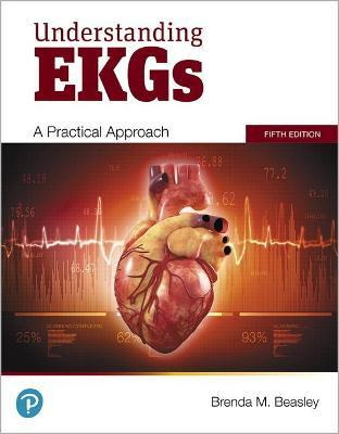 Understanding Ekgs - Brenda M. Beasley