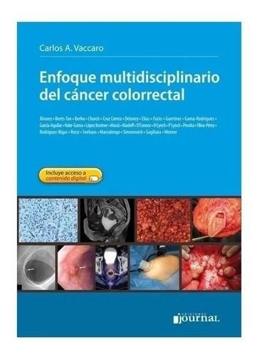 Enfoque Multidisciplinario Del Cancer Colorectal Nuevo!