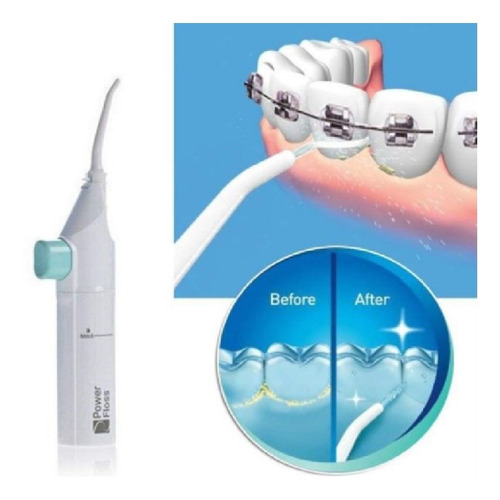 Limpiador Bucal Dental Dientes Brackers Duchador Power Floss