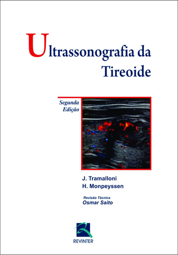Ultrassonografia da Tireóide, de Tramalloni, J.. Editora Thieme Revinter Publicações Ltda, capa mole em português, 2016
