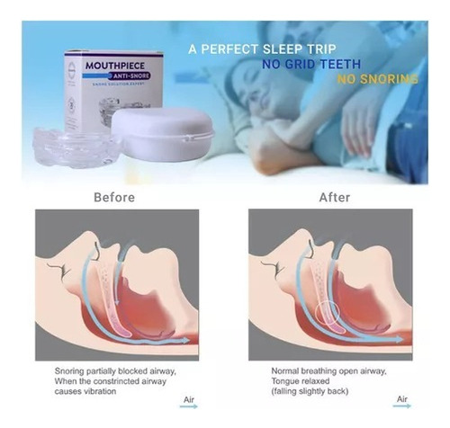 Novonovosolução Snore Air Snore Snore Snore Dispositivos Par