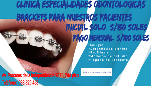 Brackets Para Ti, Corrige Tus Dientes