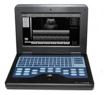 Comprar Ecografo Portatil Contec Cms600p2 Con Transductor Convexo