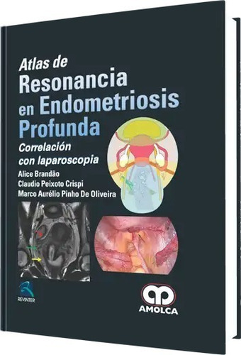 Atlas De Resonancia En Endometriosis Profunda Brandao