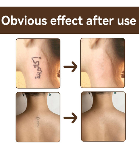 La Base De Maquillaje En U Oculta E Ilumina El Tatuaje C385