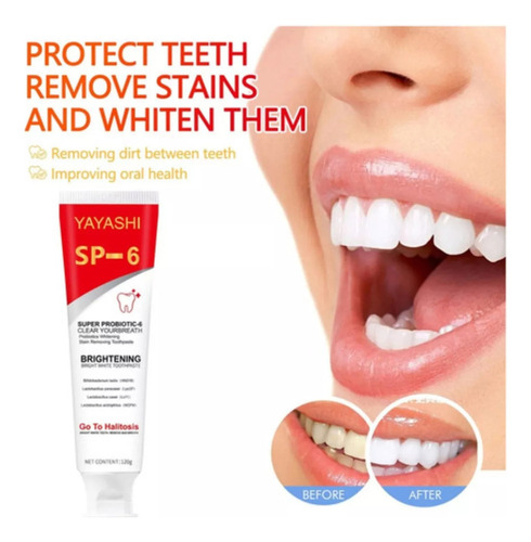 Yayashi Pasta Dental Blanqueadora Con Probióticos Sp-6 1pcs.