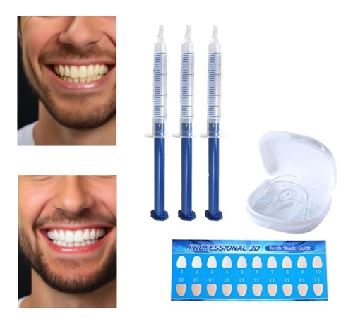 Borra Manchas Amarillas Dientes Kit X3 Jeringa Blanqueadora