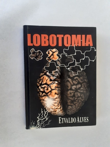 Livro: Lobotomia: Etvaldo Alves