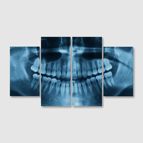 Cuadro Decorativo 4pzs Dentistas Radiografía Dental Alfadeco