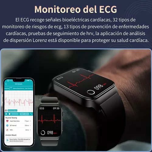 Este reloj inteligente que vende Xiaomi monitoriza la tensión arterial las  24 horas