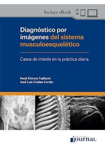 Diagnostico Por Imagenes Sistema Musculoesqueletico.kimura 