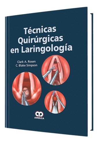 Técnicas Quirúrgicas En Laringología