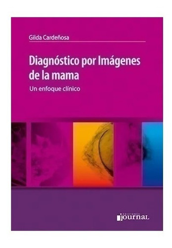 Diagnóstico Por Imágenes De La Mama Cardeñosa !