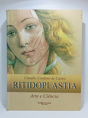 Ritidoplastia - En Portugues - Cirugia Estetica - 2007