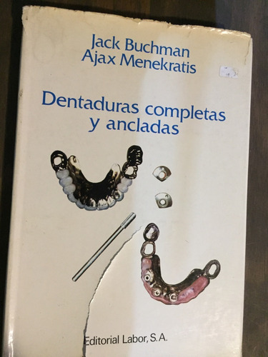 Libro Dentaduras Completas Y Ancladas - Jack Buchman. Oferta