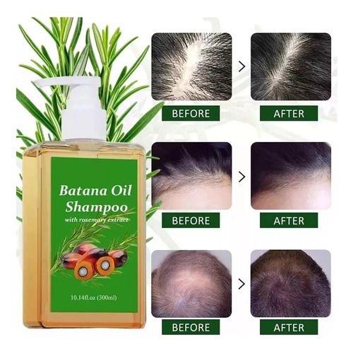 Batana - Shampoo Batana, Shampoo Com Óleo De Alecrim (1 Unid