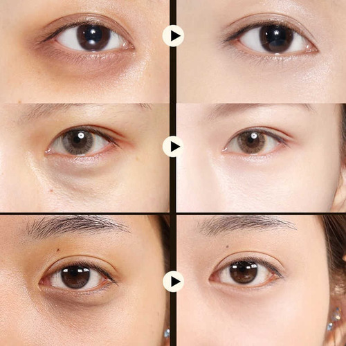 Imagen 4 de 4 de Parches Ojos Hidrogel Colageno Puro Oro Antiojeras 60pzas