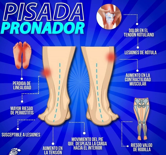 Pronación Pisada Al Correr Pronacion Neutra 2025