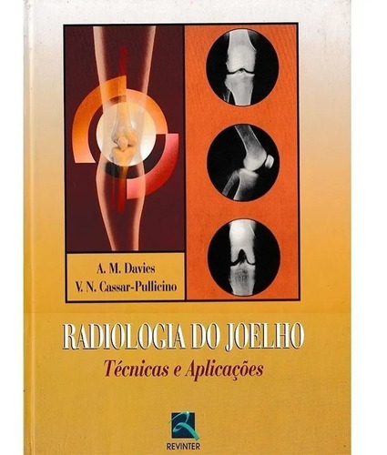 Radiologia Do Joelho - Técnicas E Aplicações