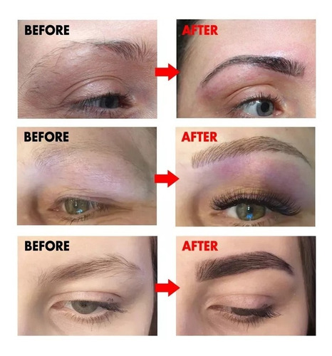 Serum Para Crecemiento De Cejas