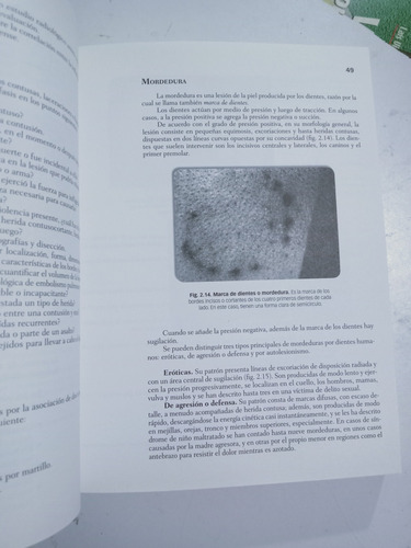 Libro Traumatología Forense / Eduardo Vargas Alvarado (Usado)