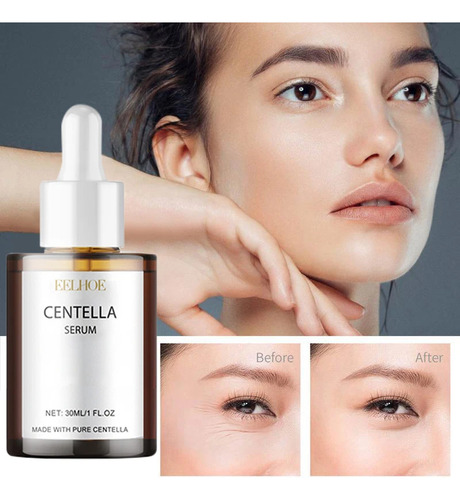 O Sérum Facial Coreano Centella Asiatica Nutre A Pele Seca
