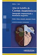 Libro Atlas De Bolsillo De Cortes Anatomicos Torax Corazon A