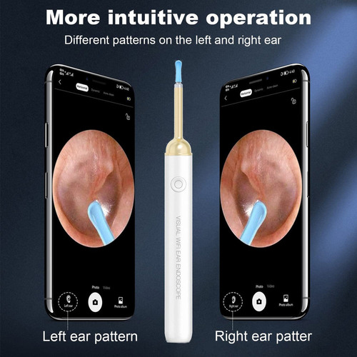 Wi-fi Visual Earpick - Kit De Herramientas De Eliminación De