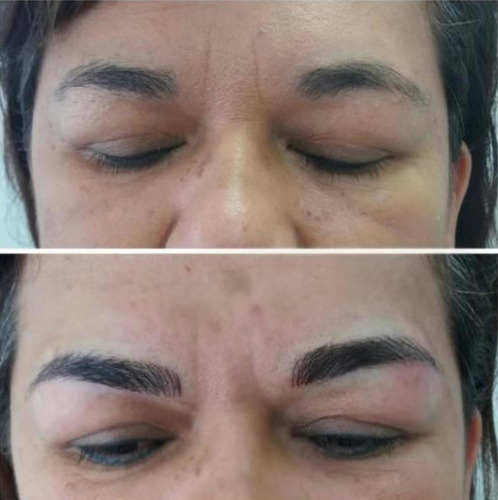 Imagen 2 de 5 de Micropigmentacion Y Microblading Cejas, Ojos Y Labios