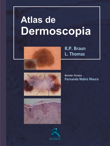 Atlas de Dermoscopia, de Braun, R. P.. Editora Thieme Revinter Publicações Ltda, capa dura em português, 2009