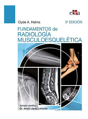 Fundamentos De Radiología Musculo Esquelética
