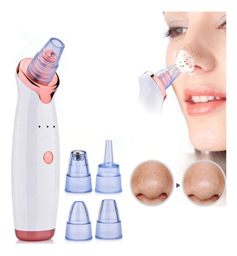 Removedor De Cravos Acne Elétrico Sucção Usb Peeling
