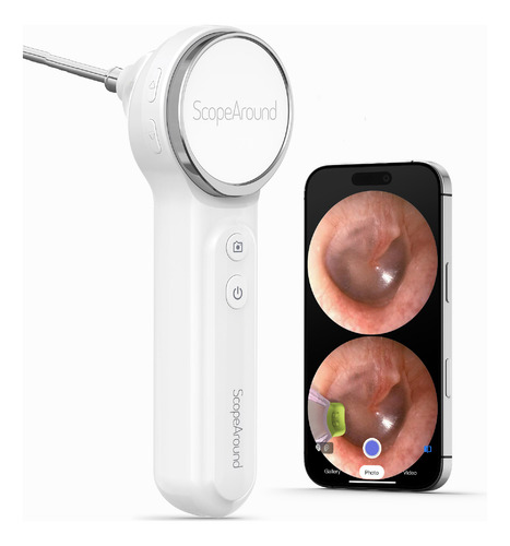Video Otoscopio Monitor Y Cámara Todo En Uno, Android, Ios