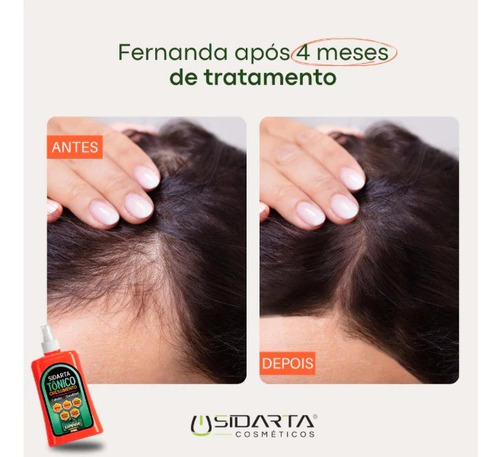 Super Tônico Tratamento Capilar Sidarta Cosméticos 250ml