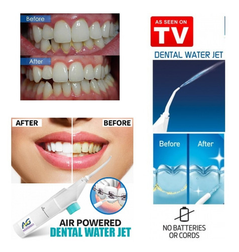 Imagen 6 de 6 de Limpiador Dental Bucal Duchador Irrigador Agnovedades