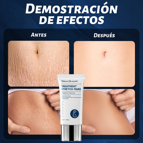Crema Para Estrías En Embarazo Eliminar Las Líneas De Embara
