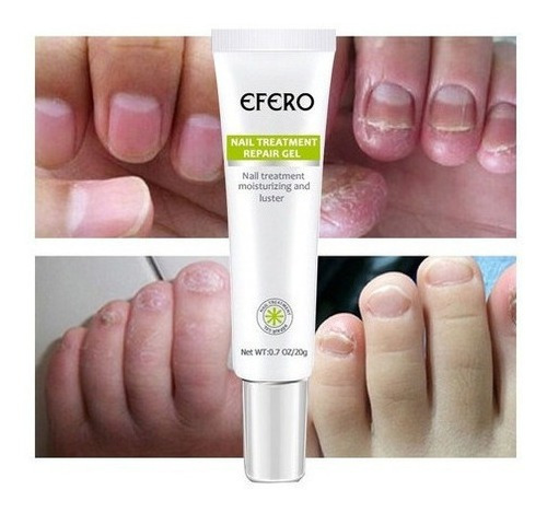 Imagen 2 de 6 de Gel De Uñas Efero De 7 Piezas, Tratamiento Eficaz Para Mi
