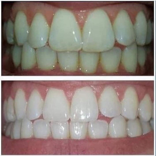 Pasta De Dientes Desmanchadora Coreana