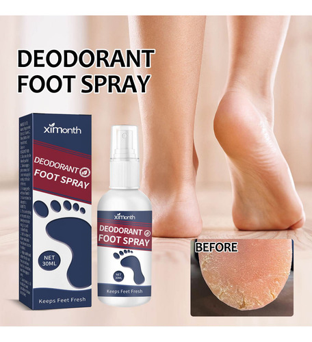 G Foot Spray Odor Control 30ml