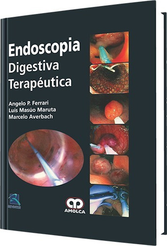 Endoscopia Digestiva Terapéutica Ferrari Amolca