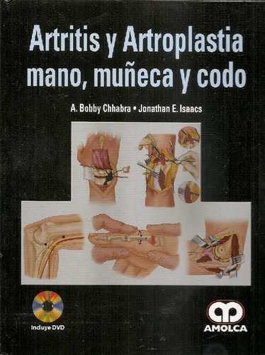 Libro Artritis Y Artroplastia Mano, Muñeca Y Codo De Bobby A