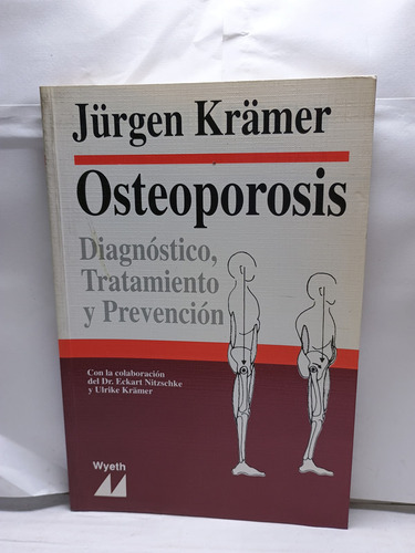 Osteoporosis Diagnostico, Tratamiento Y Prevencion