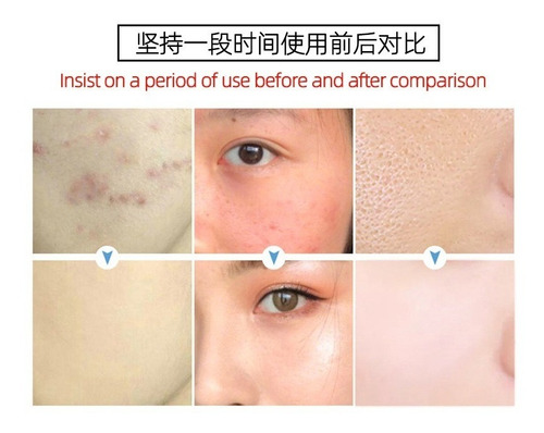 Serum Facial De Aguacate Hidratante Antiarrugas Aclarante F Tipo de piel Mixta