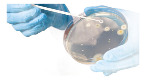 Estudio Análisis Test De Toxicidad O Bioensayos
