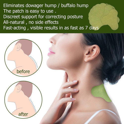 . Parche De Joroba En Hombros Y Cuello For Dolor Muscular Y