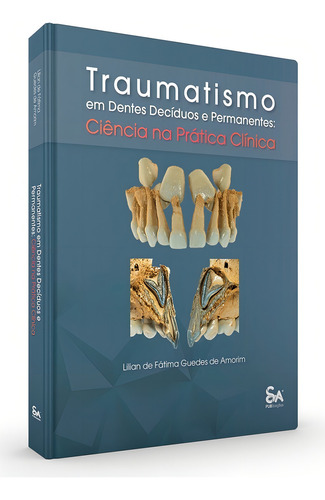 Livro Traumatismo Em Dentes Decíduos E Permanentes, 1ª Ed